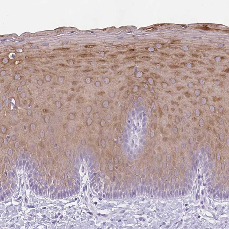 Immunohistochemistry-Paraffin KRT78 Antibody - BSA Free