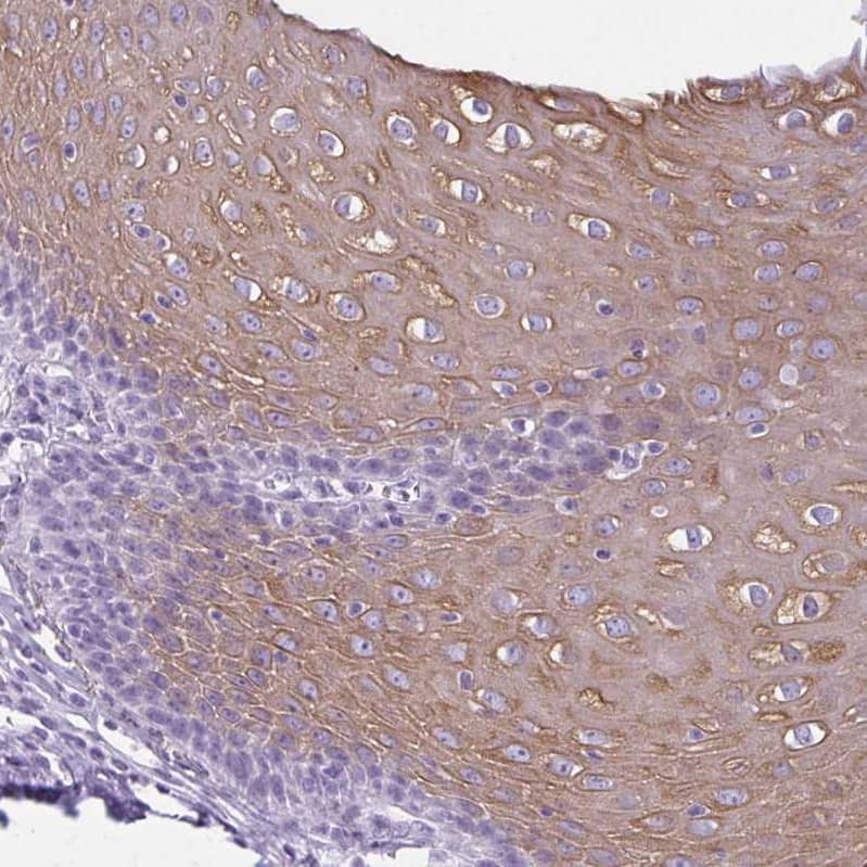 Immunohistochemistry-Paraffin KRT78 Antibody - BSA Free