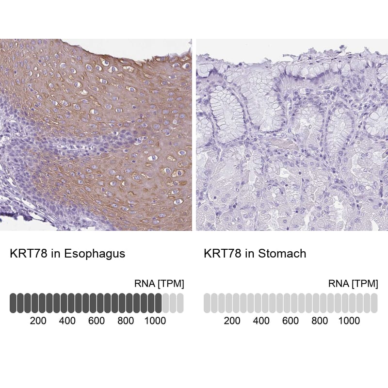 Analysis in human esophagus and stomach tissues using NBP1-93671 antibody. Corresponding KRT78 RNA-seq data are presented for the same tissues.