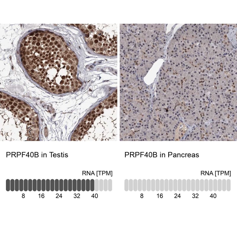 <b>Orthogonal Strategies Validation. </b>Analysis in human testis and pancreas tissues using Anti-PRPF40B antibody. Corresponding PRPF40B RNA-seq data are presented for the same tissues.