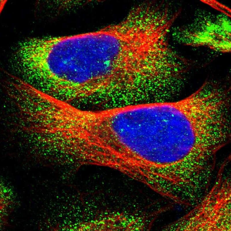 Staining of human cell line U-2 OS shows localization to cytosol.