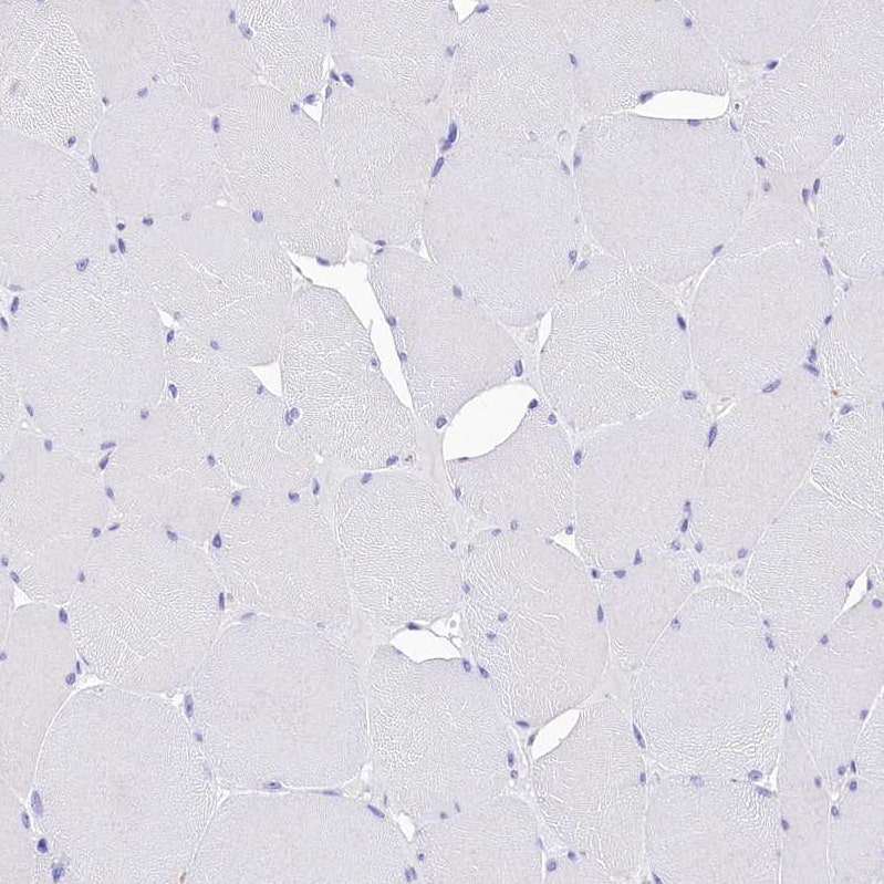 Staining of human skeletal muscle shows no positivity in myocytes as expected.