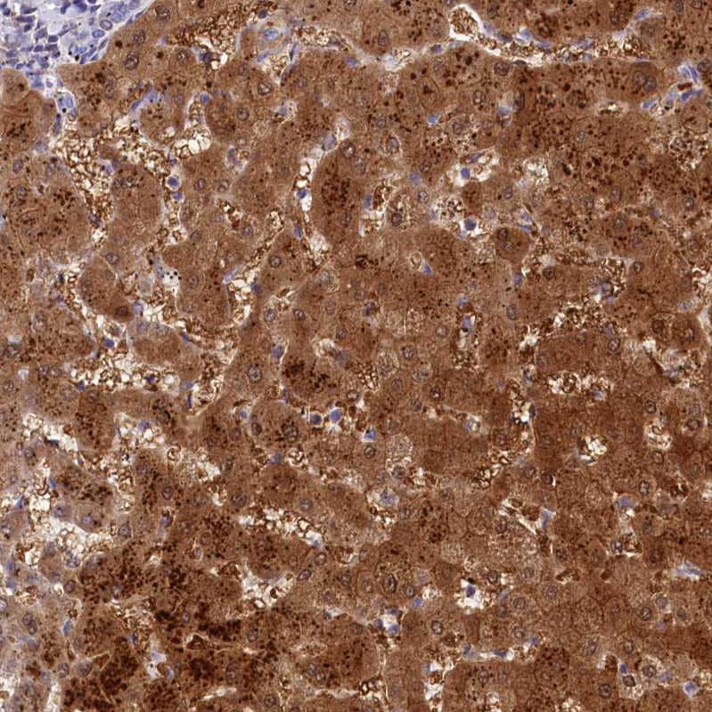 Staining of human liver shows strong cytoplasmic positivity in hepatocytes.