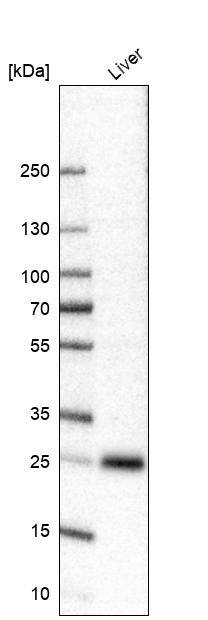 Analysis in human liver tissue.