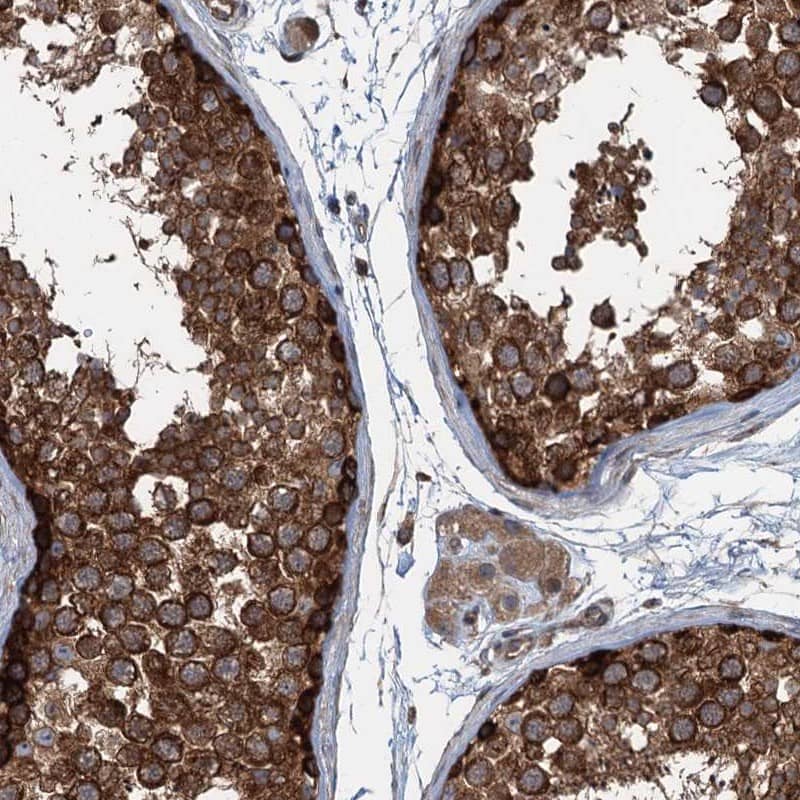 Staining of human testis shows strong cytoplasmic positivity in cells in seminiferus tubules.