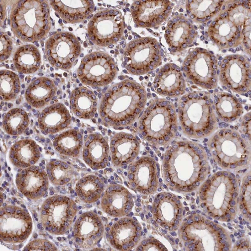 Immunohistochemistry-Paraffin TMEM181 Antibody - BSA Free