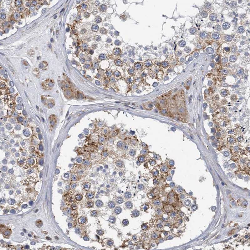 Immunohistochemistry-Paraffin CCDC47 Antibody - BSA Free