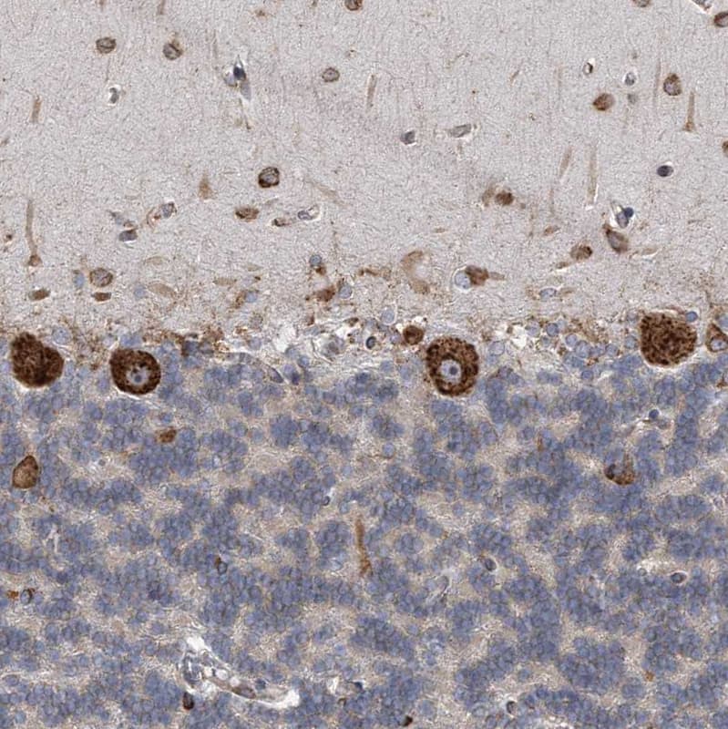 Immunohistochemistry-Paraffin CCDC47 Antibody - BSA Free