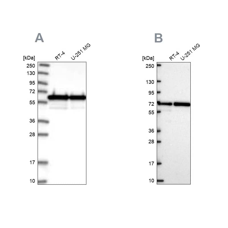 Analysis using antibody NBP1-93717 (A) shows similar pattern to independent antibody NBP2-56445 (B).