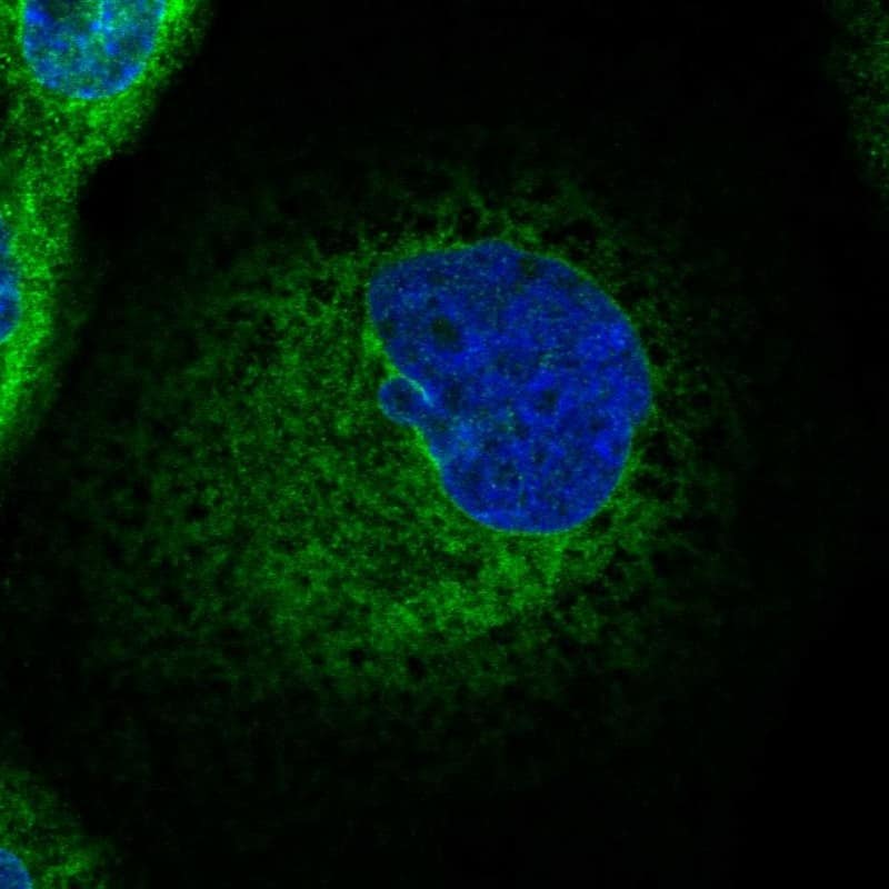Staining of human cell line A-431 shows localization to endoplasmic reticulum.