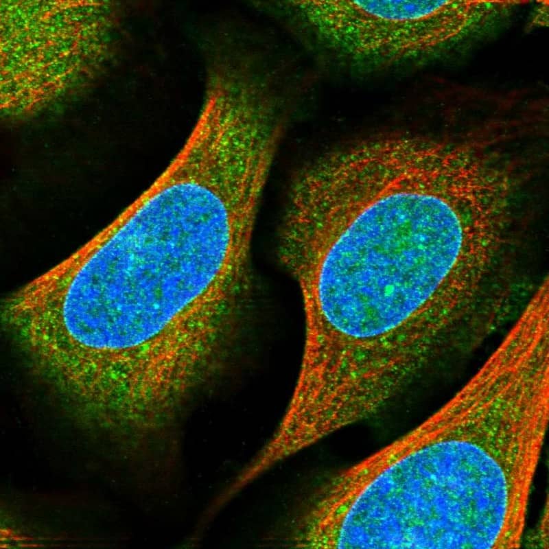 Staining of human cell line U-2 OS shows localization to nuclear membrane & cytosol.
