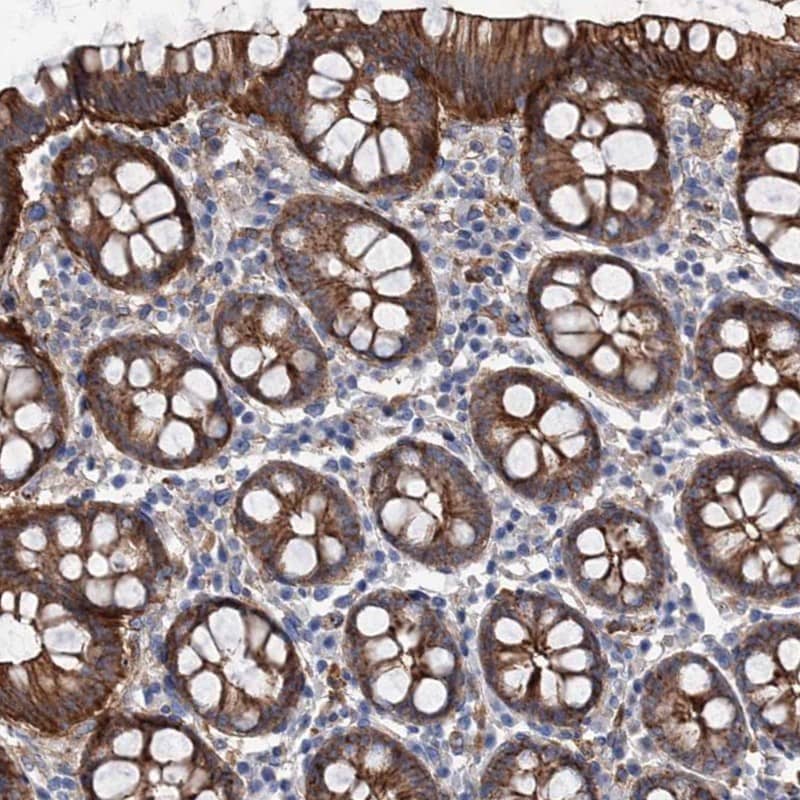 Immunohistochemistry-Paraffin TMTC3 Antibody - BSA Free