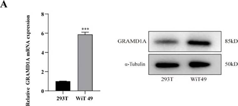 Functional Characterization of GRAMD1A in WiT-49 Wilms Tumor Cells. (A) GRAMD1A expression levels in WiT-49 cells, demonstrating baseline expression prior to gene silencing. (B) Verification of GRAMD1A knockdown efficiency in WiT-49 cells transfected with GRAMD1A-specific siRNA (siGRAMD1A) or negative control siRNA (siNC). GRAMD1A mRNA levels were measured using RT-qPCR, while protein levels were assessed via Western blot analysis. (C) Colony formation assay showing the effects of GRAMD1A silencing on the proliferation capability of WiT-49 cells, highlighting reduced colony formation in GRAMD1A knockdown cells compared to siNC. (D) CCK-8 assay results depicting the effect of GRAMD1A knockdown on cell viability over time in WiT-49 cells. Cells transfected with siGRAMD1A exhibited significantly reduced viability compared to control cells, indicating GRAMD1A’s role in promoting cell proliferation. (E) Transwell migration and invasion assays used to assess the impact of GRAMD1A silencing on the migratory and invasive behavior of WiT-49 cells. GRAMD1A knockdown led to a marked reduction in both migration and invasion compared to the negative control group. These results collectively demonstrate the role of GRAMD1A in regulating the proliferation, migration, and invasion of WiT-49 cells, further supporting its potential as a therapeutic target in Wilms Tumor. (*p < 0.05, **p < 0.01, ***p < 0.001). Image collected and cropped by CiteAb from the following open publication (//pubmed.ncbi.nlm.nih.gov/39659787), licensed under a CC-BY license. Not internally tested by Novus Biologicals.