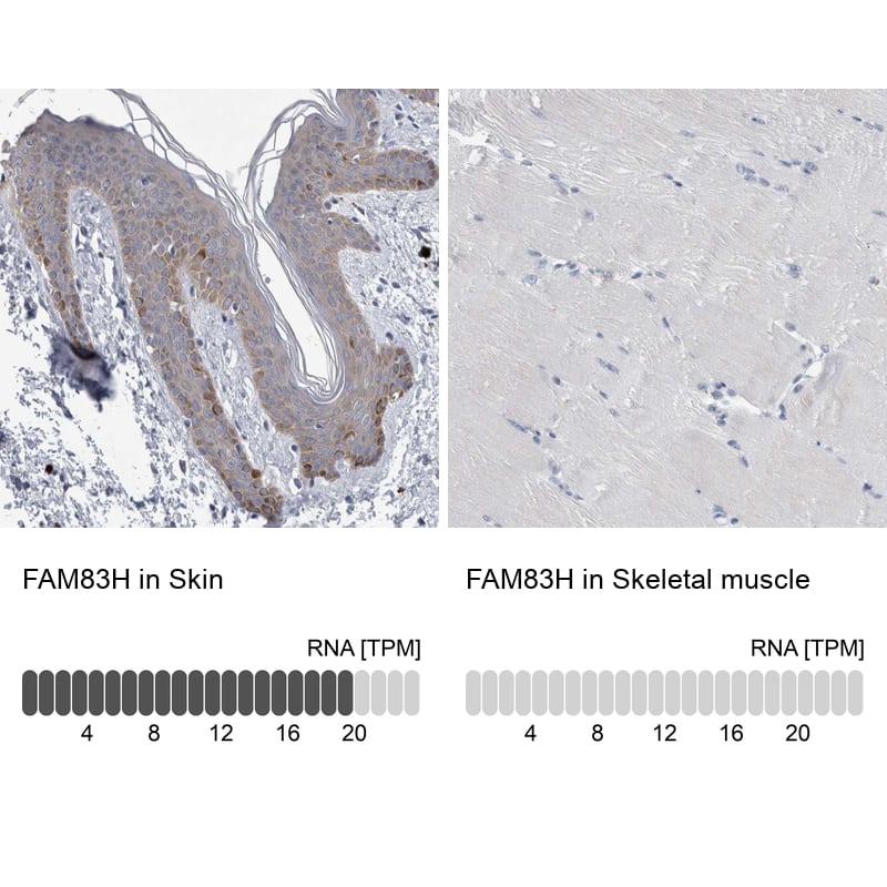 Analysis in human skin and skeletal muscle tissues using NBP1-93737 antibody. Corresponding FAM83H RNA-seq data are presented for the same tissues.
