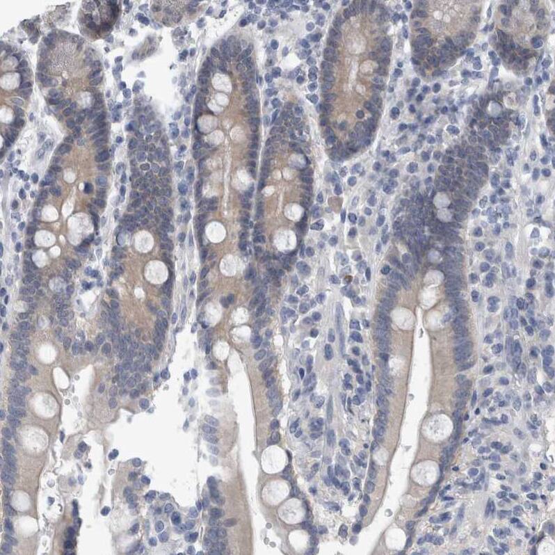 Staining of human duodenum shows weak cytoplasmic positivity in glandular cells.