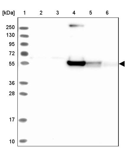 Lane 1: Marker [kDa] 250, 130, 95, 72, 55, 36, 28, 17, 10Lane 2: Human cell line RT-4Lane 3: Human cell line U-251MG spLane 4: Human plasma (IgG/HSA depleted)Lane 5: Human liver tissueLane 6: Human tonsil tissue