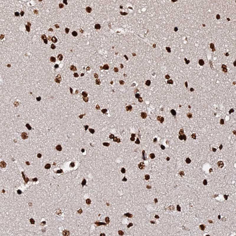 Immunohistochemistry DNAH10OS Antibody - BSA Free