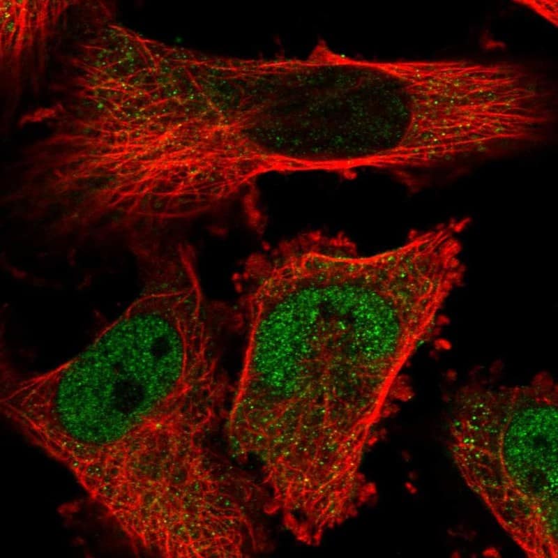 Staining of human cell line U-251 MG shows localization to nucleoplasm & cytosol.