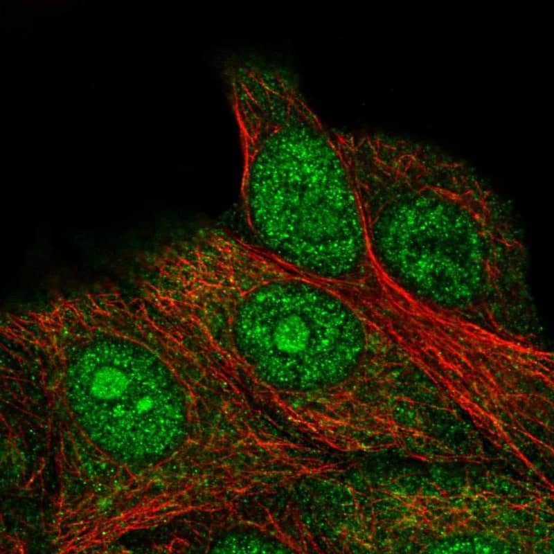Staining of human cell line MCF7 shows localization to nucleus, nucleoli & cytosol.