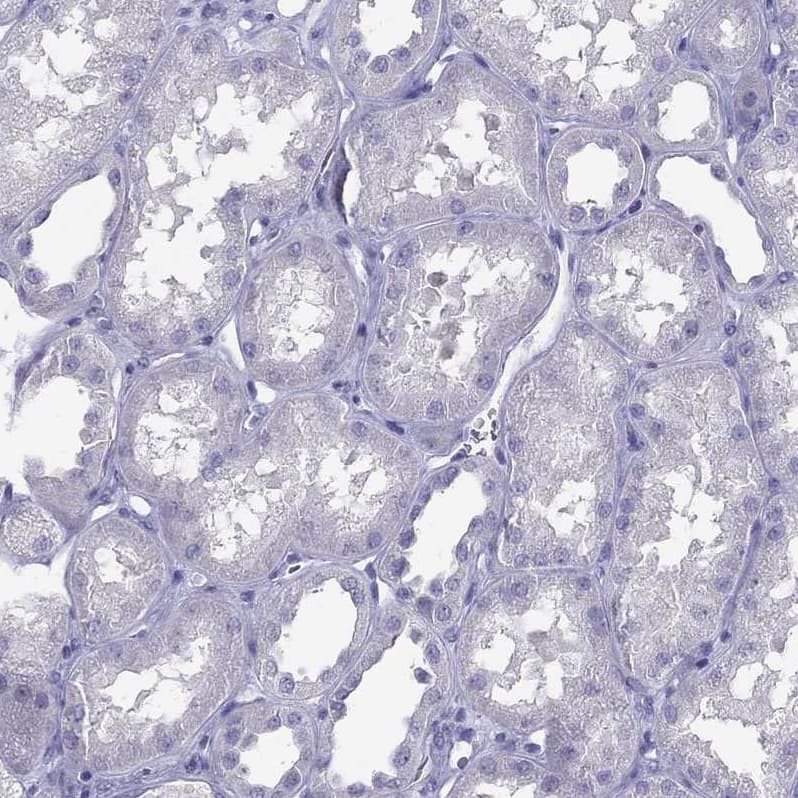 Staining of human kidney shows negative cytoplasmic positivity in cells in tubules as expected.