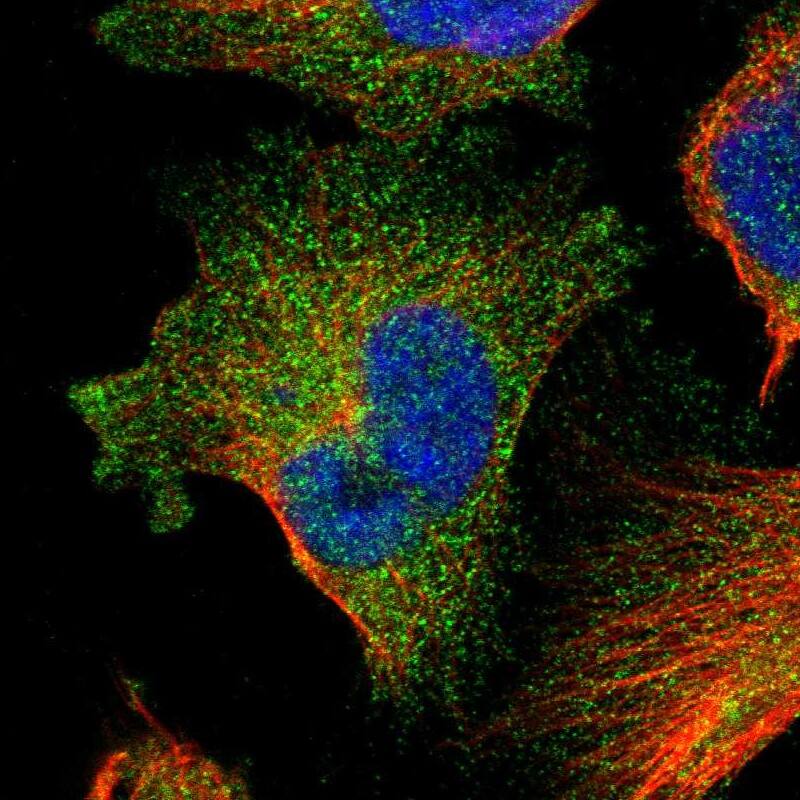 Staining of human cell line U-251 MG shows localization to cytosol.