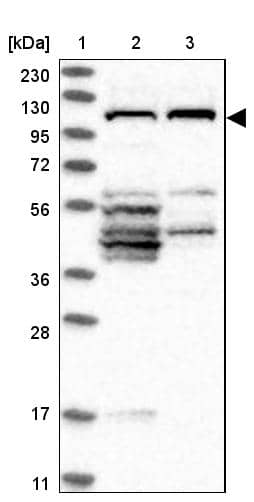 Lane 1: Marker [kDa] 230, 130, 95, 72, 56, 36, 28, 17, 11Lane 2: Human cell line RT-4Lane 3: Human cell line U-251MG sp