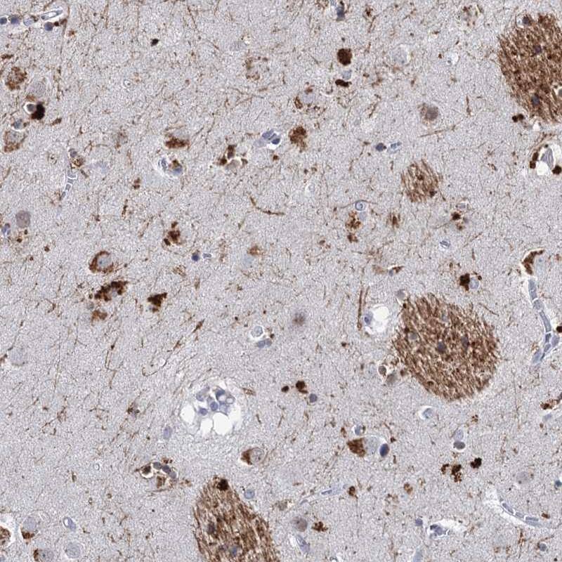 Immunohistochemistry-Paraffin C16orf72 Antibody - BSA Free
