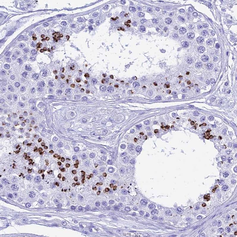 Staining of human testis shows strong cytoplasmic positivity  in cells in seminiferous ducts.