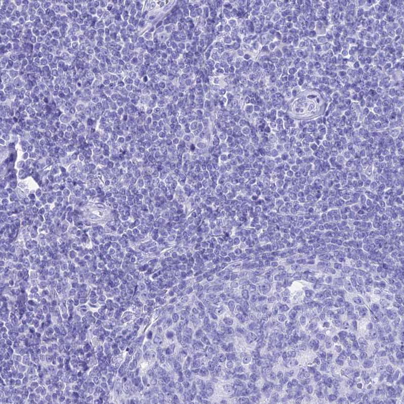 Staining of human tonsil shows no positivity in non-germinal center cells as expected.