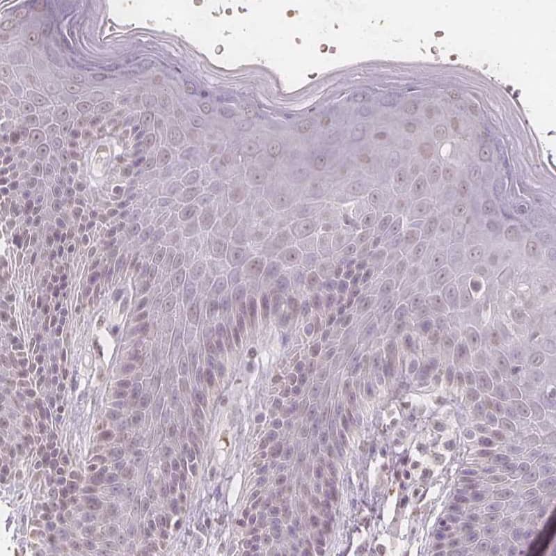 Staining of human skin shows no positivity in squamous epithelial cells as expected.