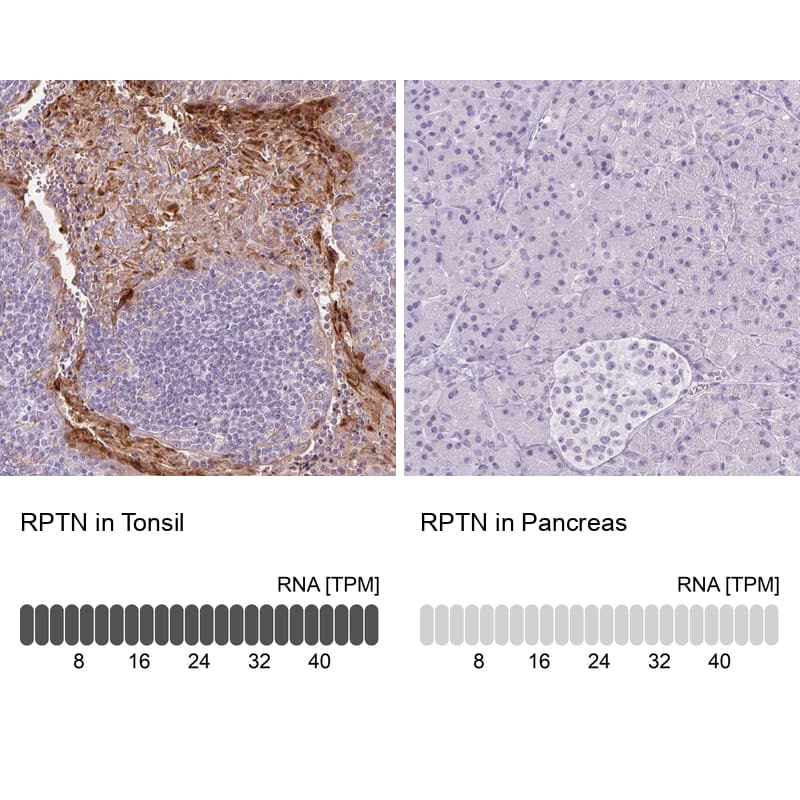Immunohistochemistry-Paraffin RPTN Antibody - BSA Free