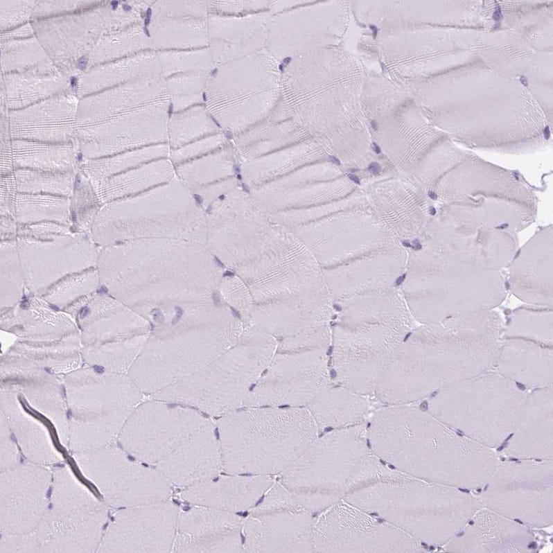Immunohistochemistry-Paraffin RPTN Antibody - BSA Free