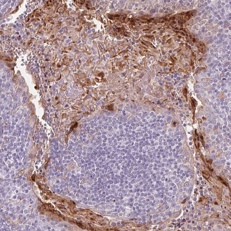 Immunohistochemistry-Paraffin RPTN Antibody - BSA Free