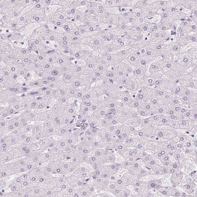 Immunohistochemistry-Paraffin RPTN Antibody - BSA Free