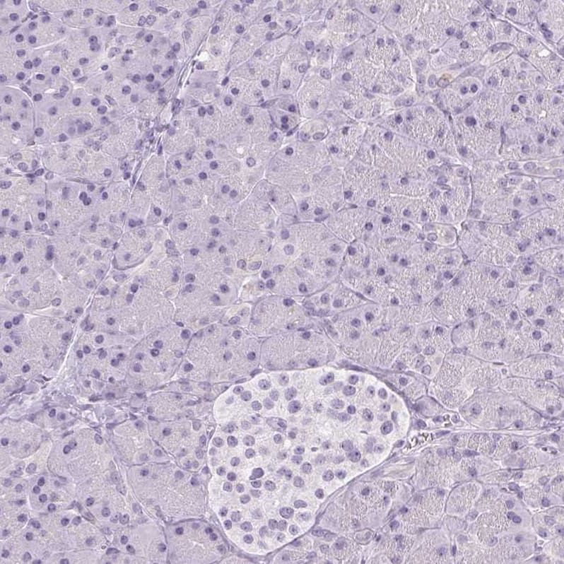 Immunohistochemistry-Paraffin RPTN Antibody - BSA Free