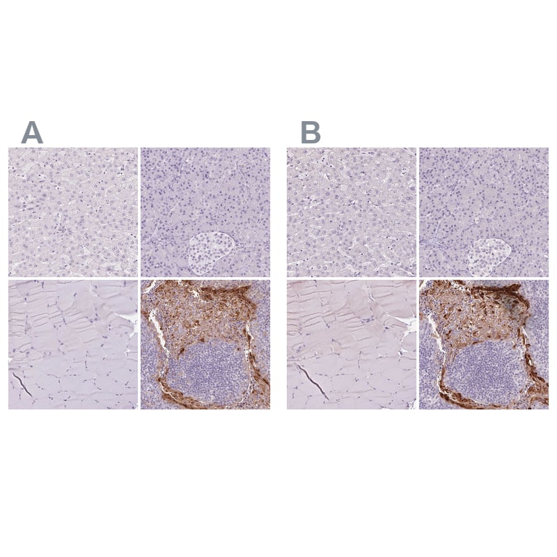 Immunohistochemistry-Paraffin RPTN Antibody - BSA Free