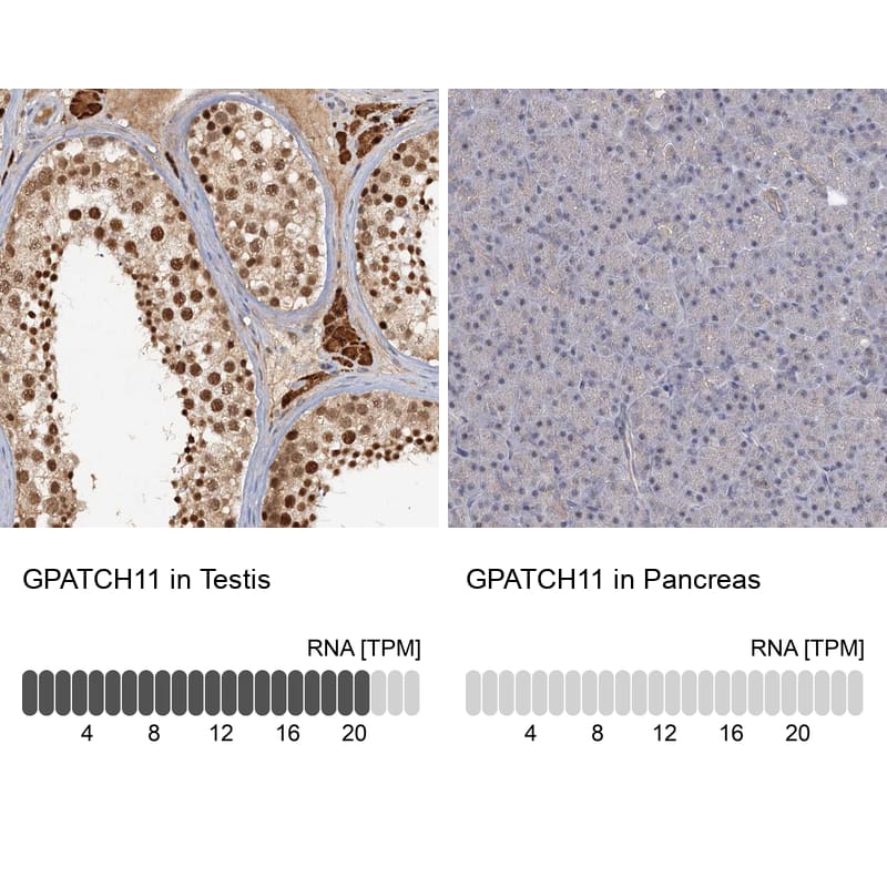 <b>Orthogonal Strategies Validation. </b>Analysis in human testis and pancreas tissues using NBP1-93801 antibody. Corresponding GPATCH11 RNA-seq data are presented for the same tissues.