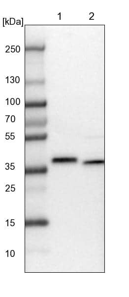 Lane 1: NIH-3T3 cell lysate (Mouse embryonic fibroblast cells)Lane 2: NBT-II cell lysate (Rat Wistar bladder tumour cells)
