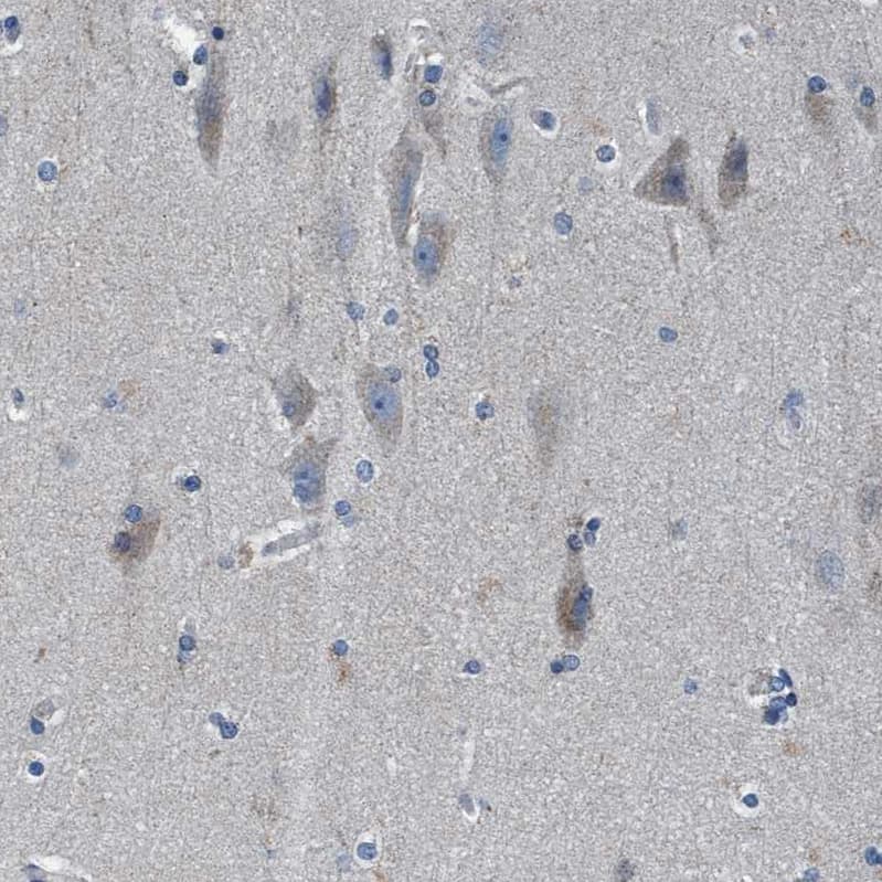 Staining of human cerebral cortex shows moderate cytoplasmic positivity in neurons.
