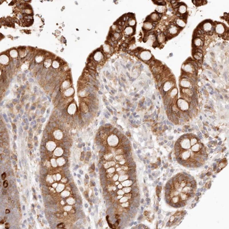 Staining of human colon shows strong cytoplasmic positivity in glandular cells.