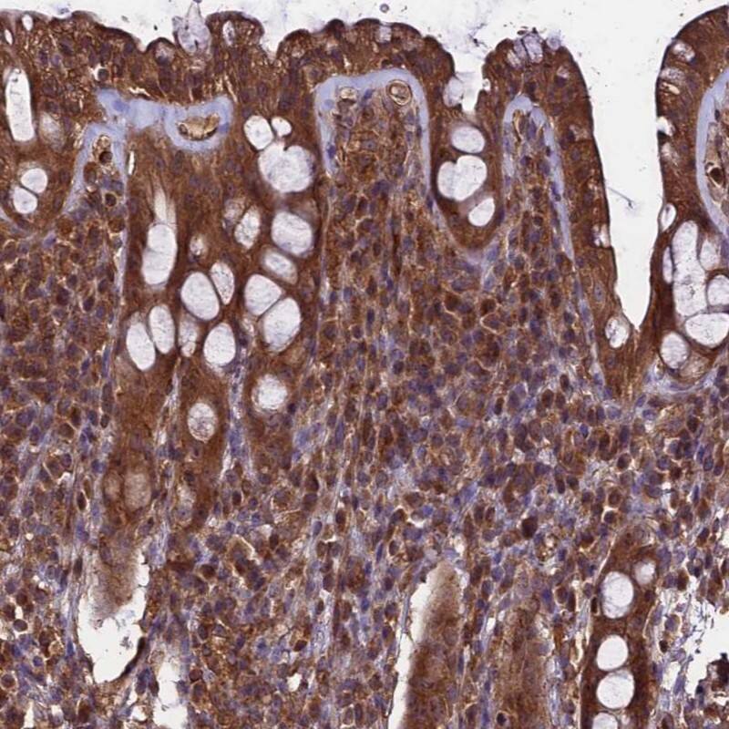 Staining of human rectum shows moderate cytoplasmic positivity in glandular cells.