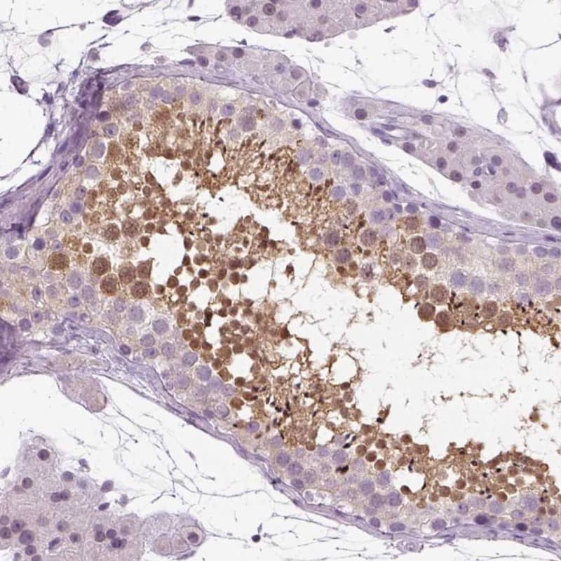 Immunohistochemistry-Paraffin SPATA31E1 Antibody - BSA Free