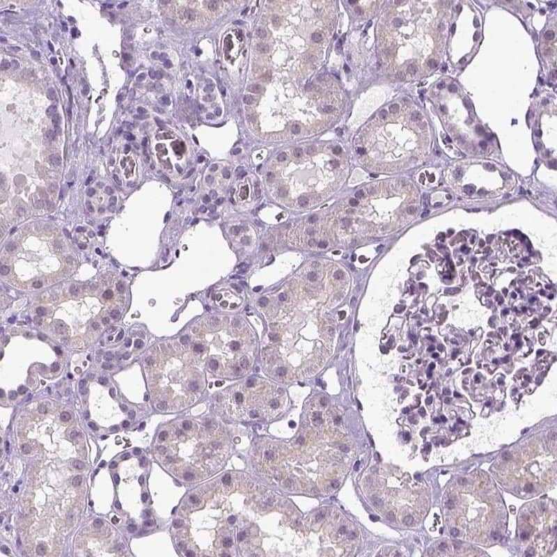 Immunohistochemistry-Paraffin SPATA31E1 Antibody - BSA Free