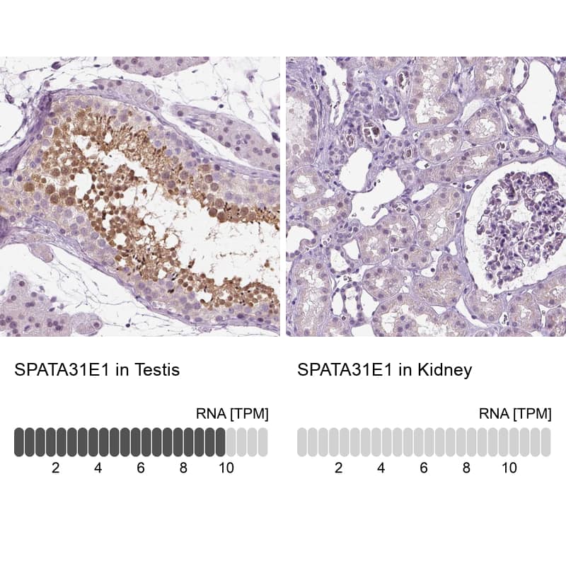 Analysis in human testis and kidney tissues using Anti-SPATA31E1 antibody. Corresponding SPATA31E1 RNA-seq data are presented for the same tissues.