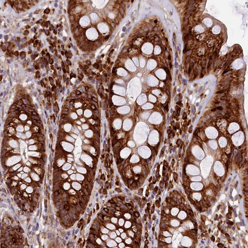 Staining of human rectum shows strong cytoplasmic positivity in glandular cells.