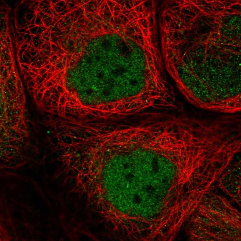 Staining of human cell line A-431 shows localization to nucleoplasm.