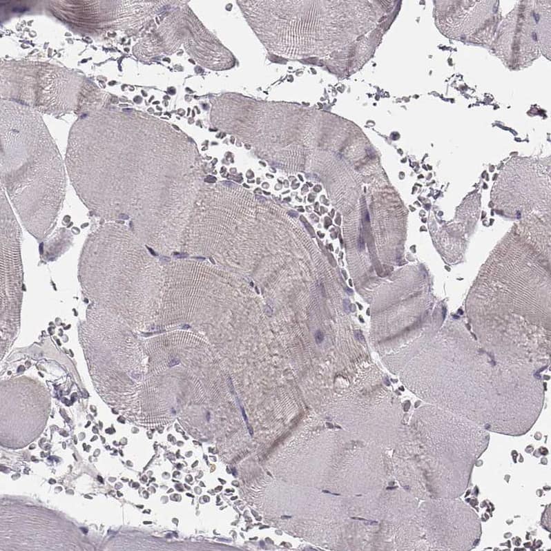 Immunohistochemistry SPAG17 Antibody - BSA Free