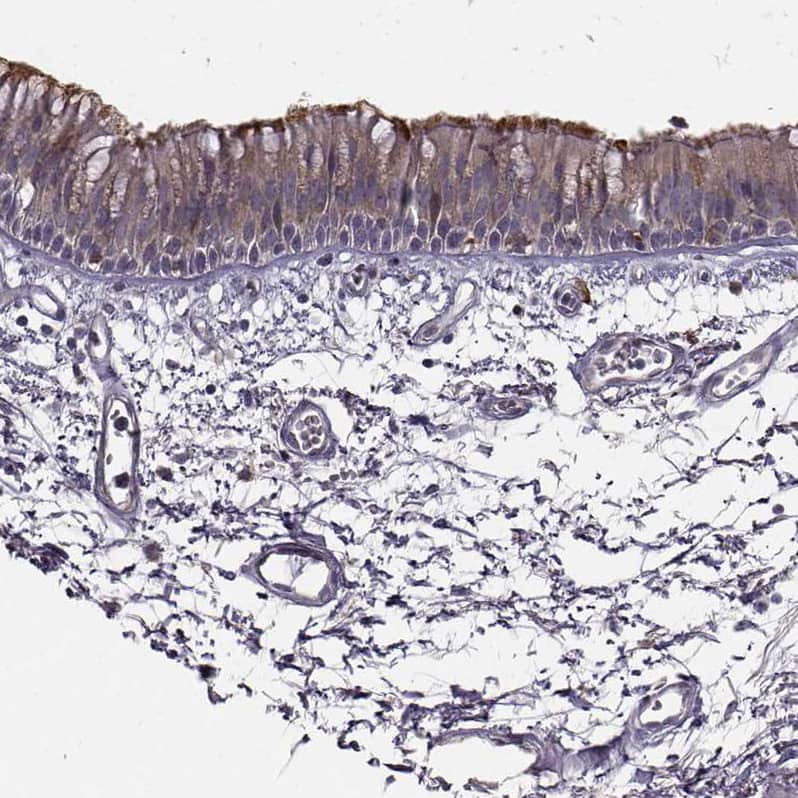 Staining of human bronchus shows moderate to strong positivity in cilia in respiratory epithelial cells.