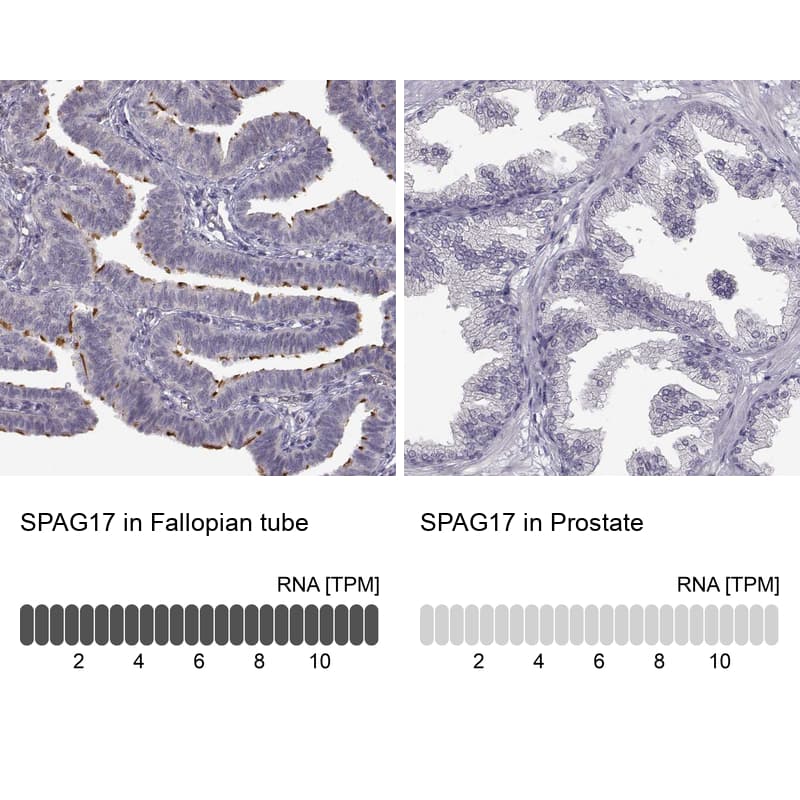 <b>Orthogonal Strategies Validation. </b>Analysis in human fallopian tube and prostate tissues using NBP1-93841 antibody. Corresponding SPAG17 RNA-seq data are presented for the same tissues.