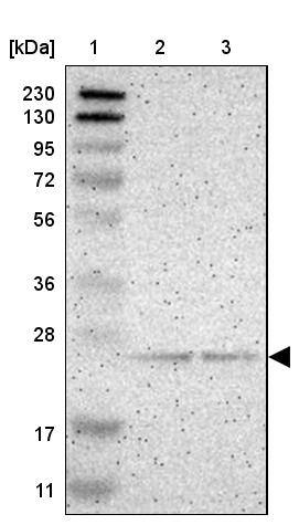 Lane 1: Marker [kDa] 230, 130, 95, 72, 56, 36, 28, 17, 11Lane 2: Human cell line RT-4Lane 3: Human cell line U-251MG sp